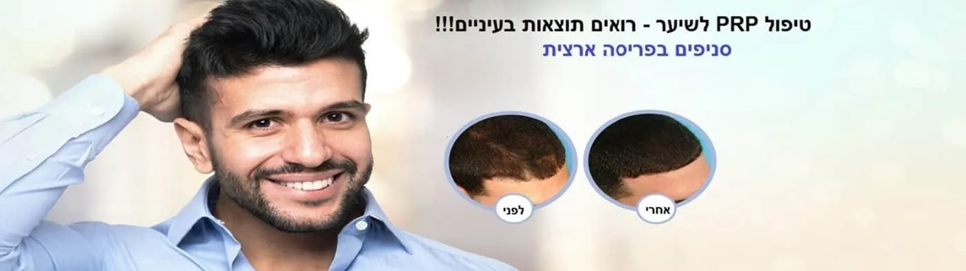 טיפול PRP לשיער בראשון לציון