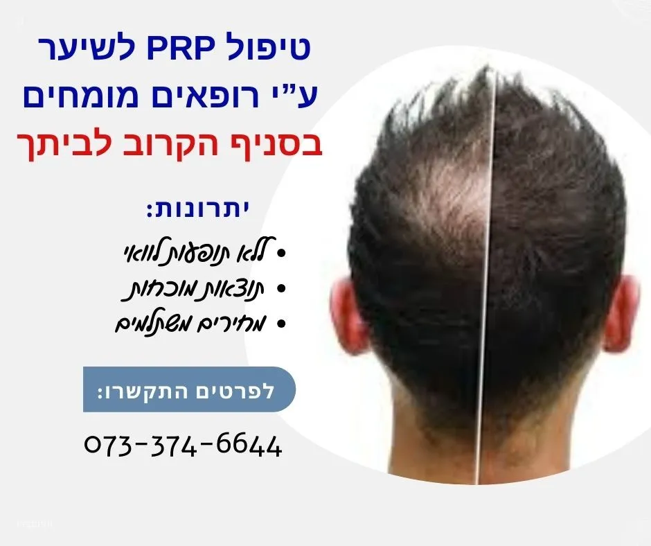 טיפול PRP לשיער בקריית מוצקין