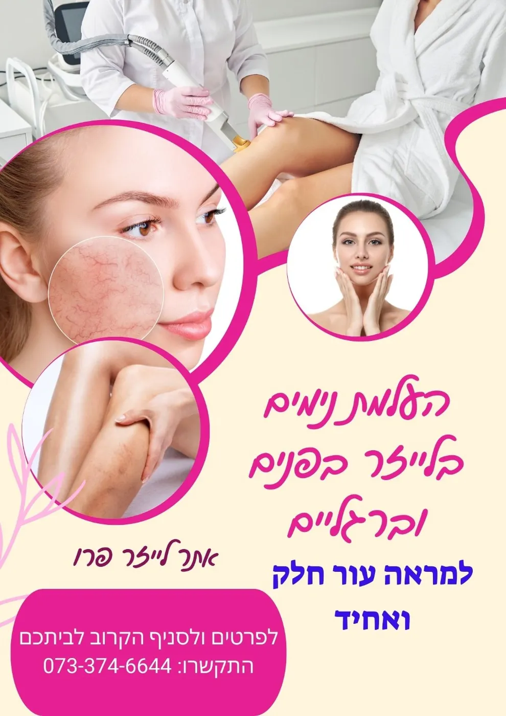 הסרת נימים בקריית מוצקין