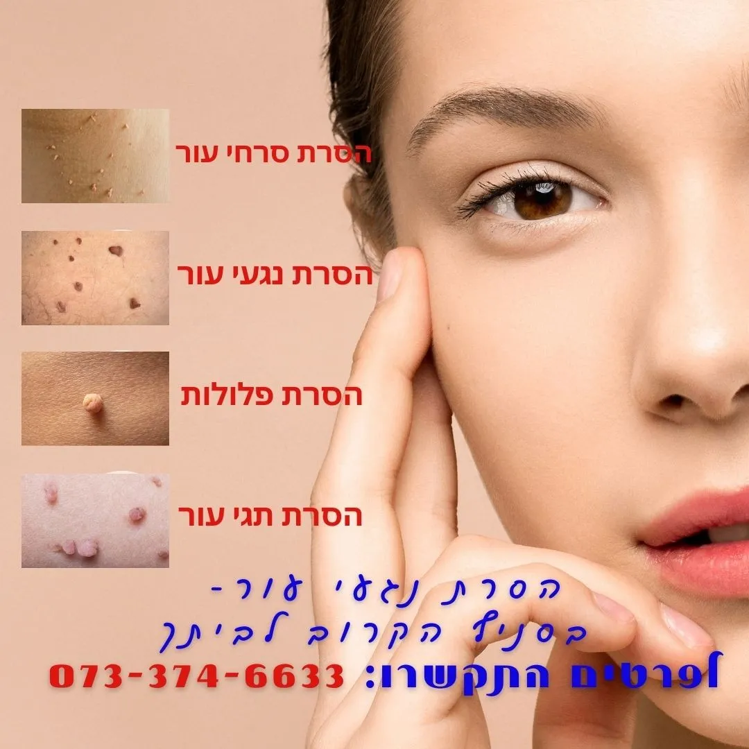 הסרת סרחי עור בקריית מוצקין