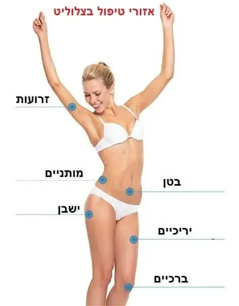 אזורי טיפול בצלוליט