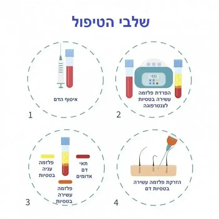 שלבי טיפול PRP לברך